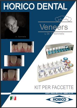 KIT AS – Präparation von Veneers