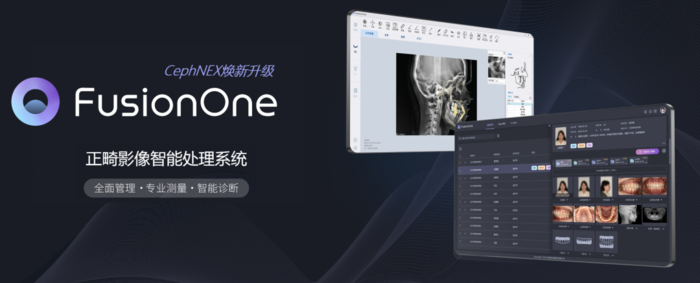 FusionOne正畸影像智能处理系统