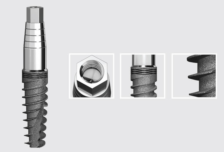 I7 Integral implant