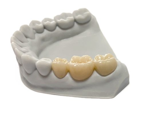 Z-Disk – AB Dental Devices Ltd., Ronden