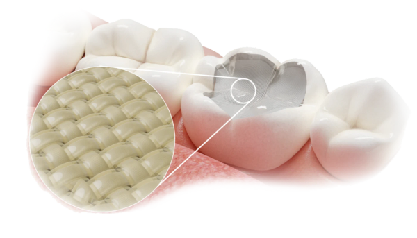 Fibrafill®