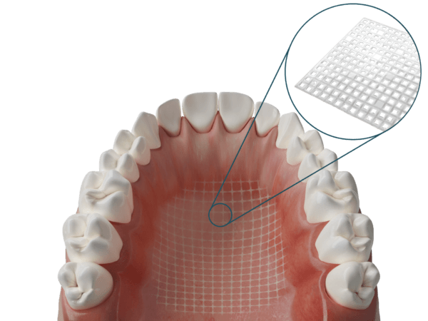 Dentapreg® MESH TranspArent – Dentapreg - ADM, a.s, Core Buildups