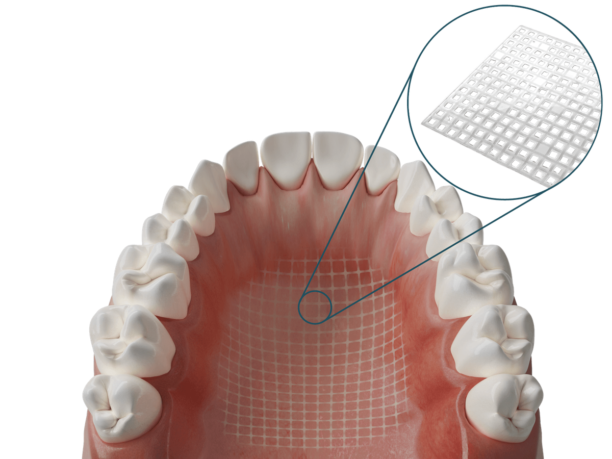 Dentapreg® MESH Transparent – Dentapreg - ADM, a.s, Resins