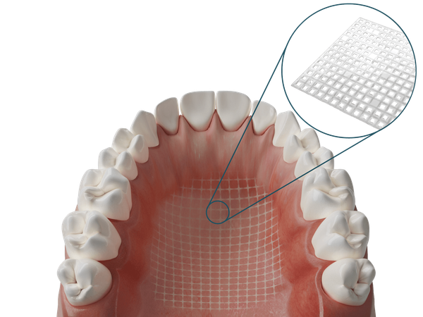Dentapreg® MESH Transparent
