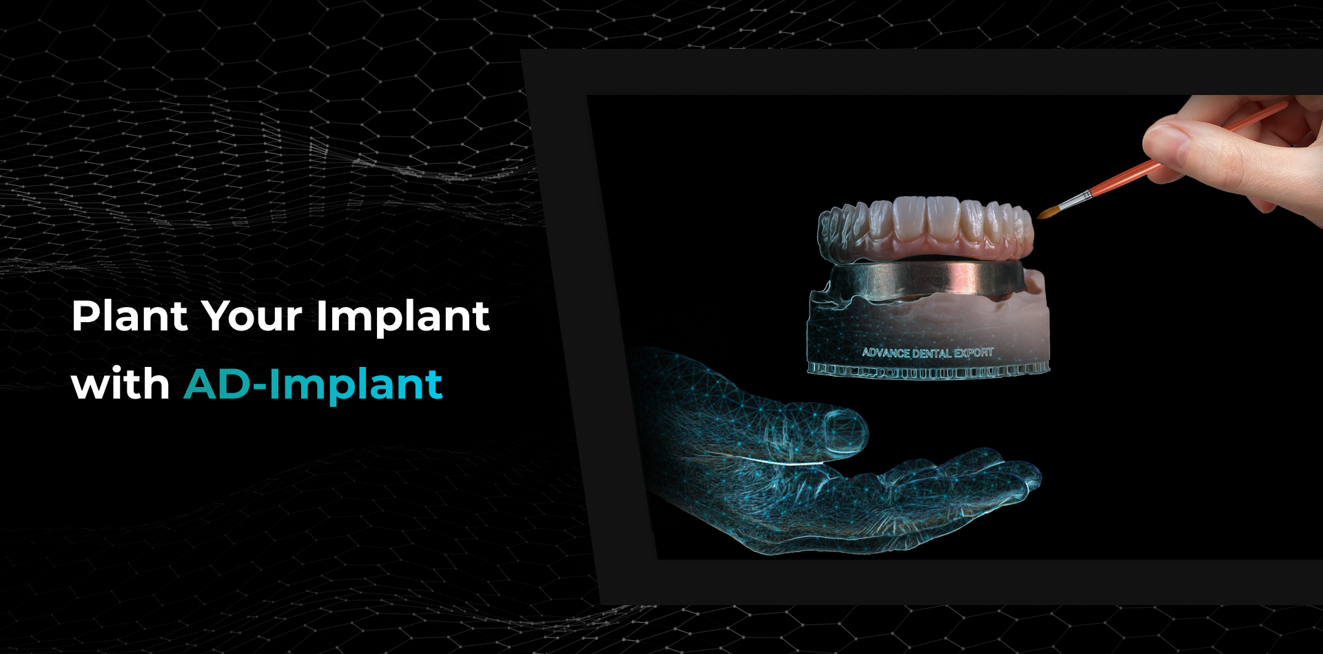 AD-Implant Prosthesis