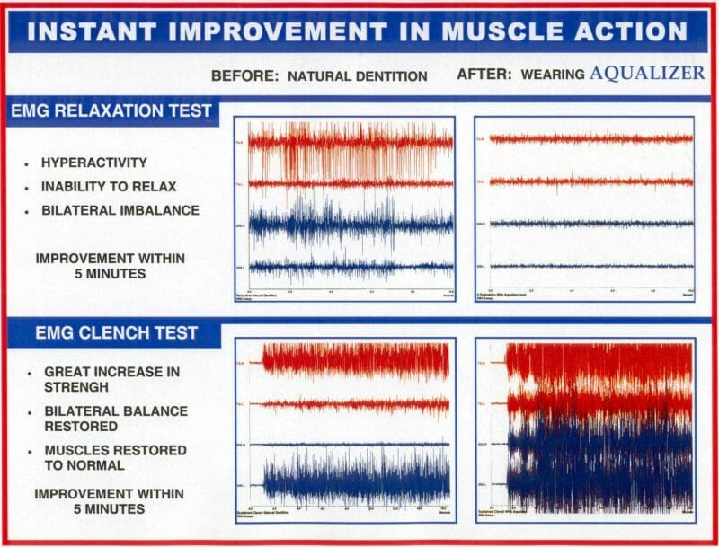 Aqualizer®
