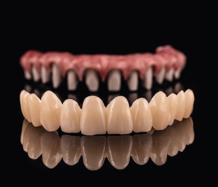 Arma Resin