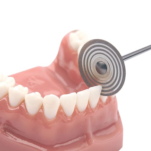 DYNAFLEX ORTHO STRIPPING DISC – Dynaflex Orthodontics USA, Polishing Discs and Strips