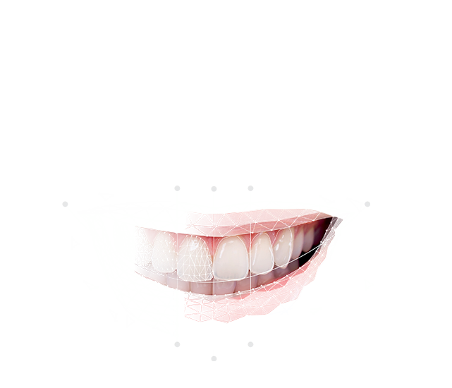 Smile Creator – Exocad, CAD/CAM Software