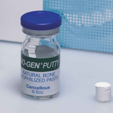 Biomateriali per rigenerazione ossea – Putty