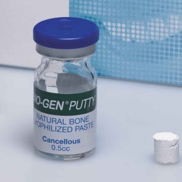 Sostituti Ossei Naturali – Putty