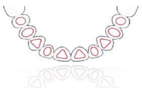 WINPeek® – BioSAF IN, Implant Components & Abutments