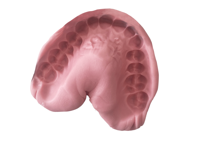 Vinylbest 4.187 – BMS Dental S.r.l., A-Silicones