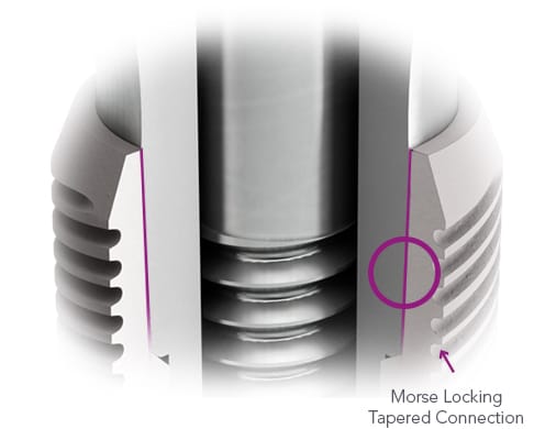CONICAL IMPLANT