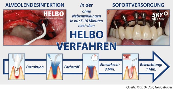 HELBO - Antimicrobial Photodynamic Therapy