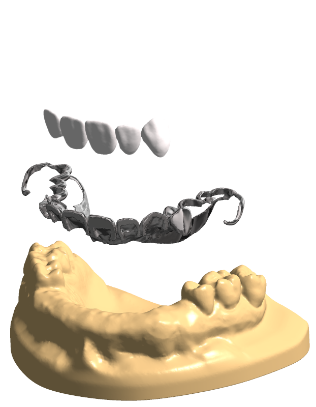 Digistell – Custom CAD