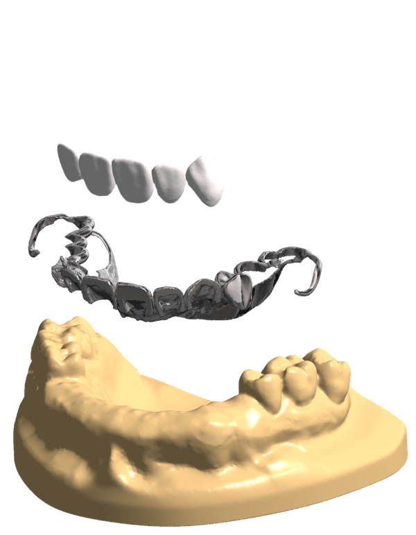 Digistell – Custom CAD