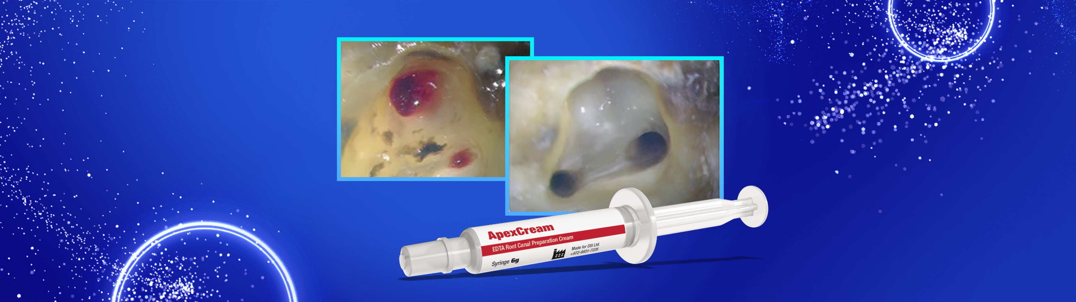 DSI ApexCream Root Canal Prep