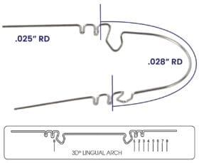 Wilson 3D Lingual Arch Pack of 3 – RMO, Intraoral Appliances