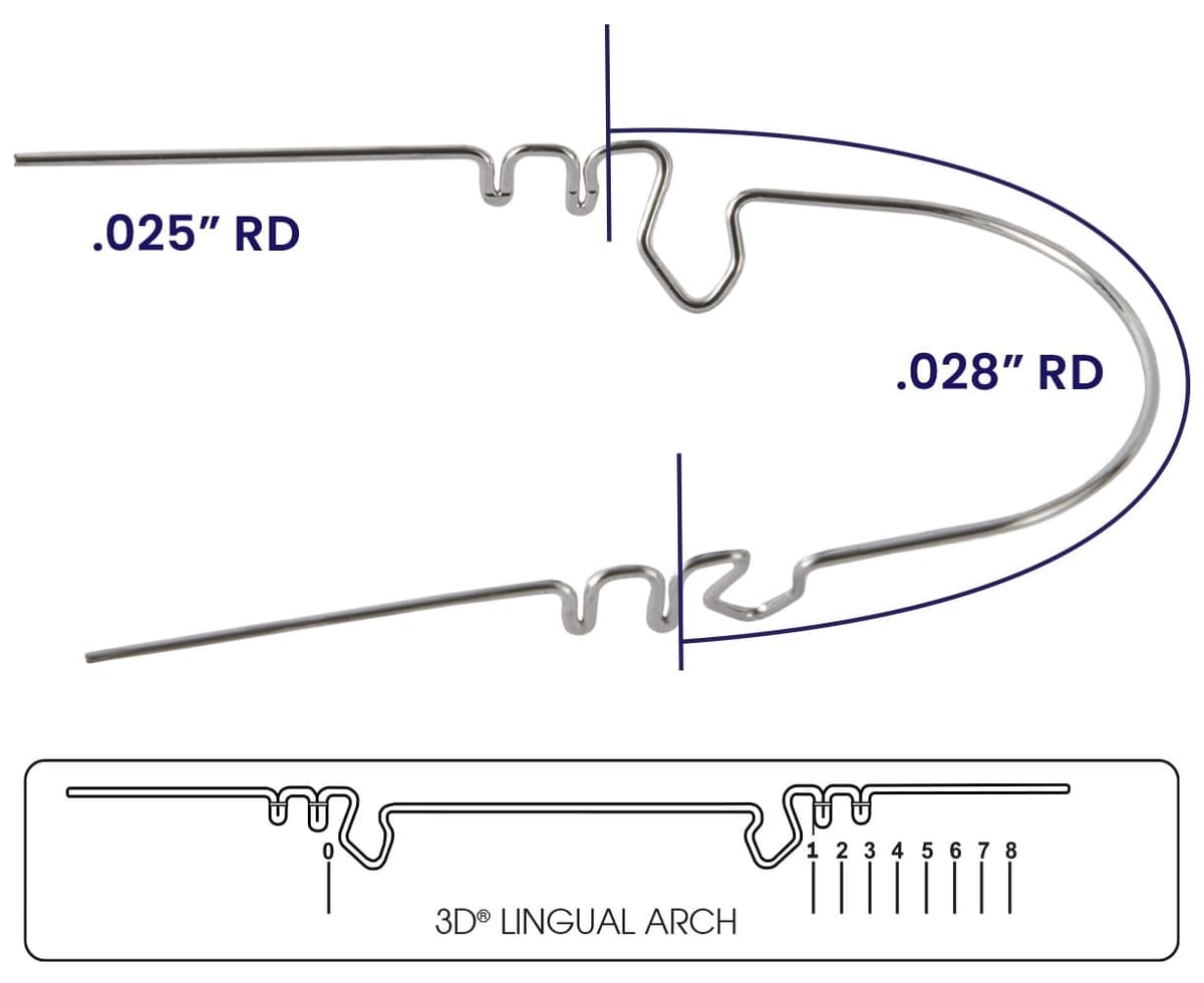 Wilson 3D Lingual Arch Pack of 3 – RMO, Intraoral Appliances