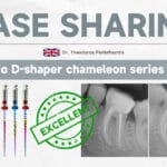 D-Shaper