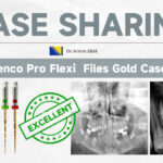 Pro Flexi Gold – Shenzhen Denco Medical Co., Ltd, Rotary Files & Reamers