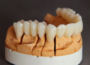 Dentalos Plus SG1a – DentalPlus, Resins