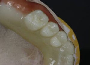 Dentalos Plus SG2 – DentalPlus, Resins