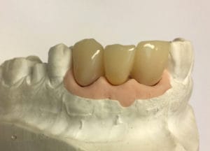 Dentalos Plus SG3a – DentalPlus, Resins