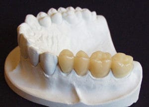 Dentalos Plus SG6a – DentalPlus, Resins