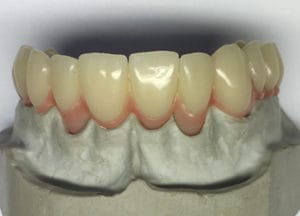 Flexistrong Plus – DentalPlus, Other Dental Laboratory Materials