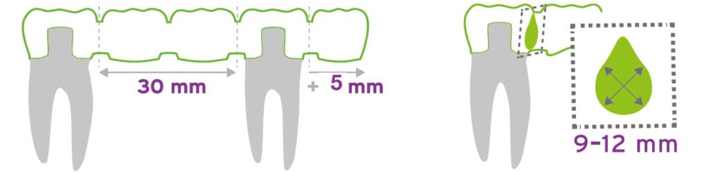 Eldy Plus® CAD/CAM – DentalPlus, Blöcke