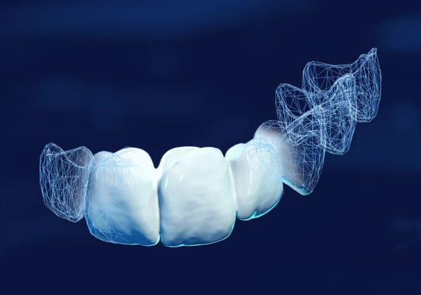 DentaTEMP
