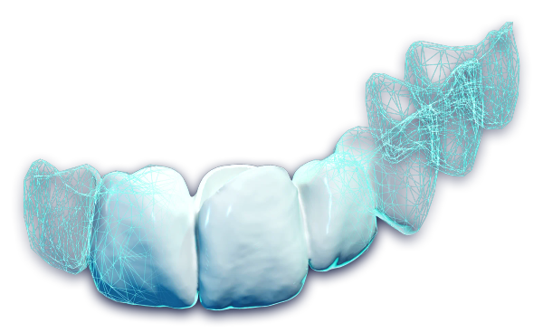 DentaBRIDGE