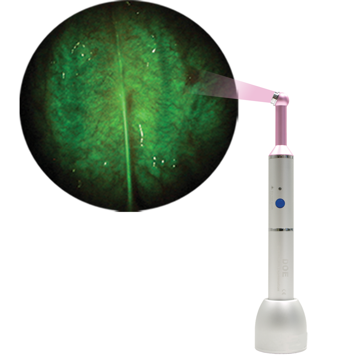DOE SE – DentLight Inc., Produits de dépistage du cancer