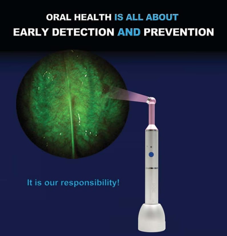 DOE SE Kit – DentLight Inc., Prophylaxis, Patient Information, Bleaching