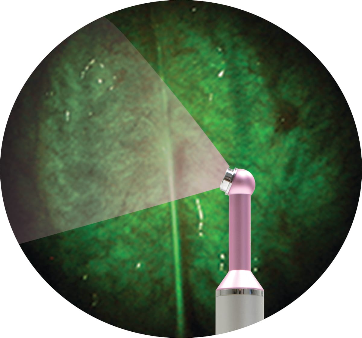 Examen buccal - DentLight – DentLight Inc., Diagnostics