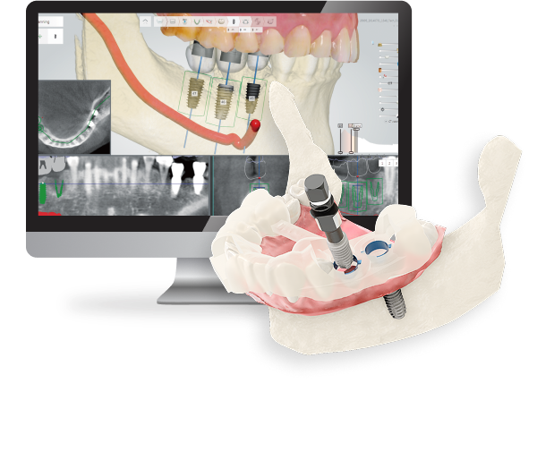 DIO NAVI – DIO IMPLANT, Equipment
