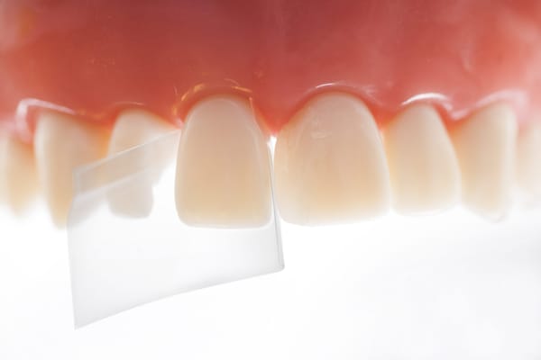 ProxyPal®