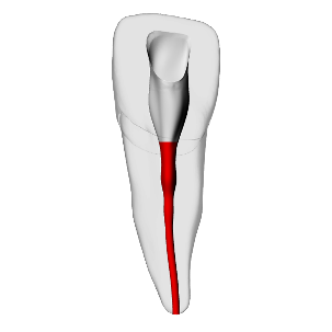 Incisor – Accessed, Basic, Radiopaque (White) | Dental Training Models | DRSK