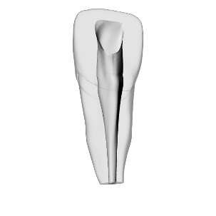 Incisor – Accessed, Narrow open apex | Dental Training Models | DRSK