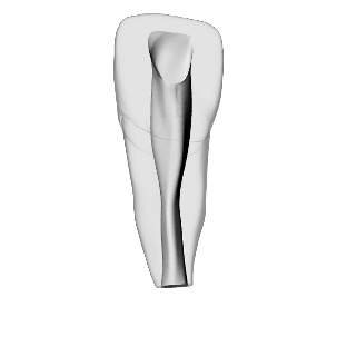 Incisive – Cavité d'accès, apex ouvert, blanche – DRSK Group AB, Gypsum Additives, Die Hardeners and Plaster Removers