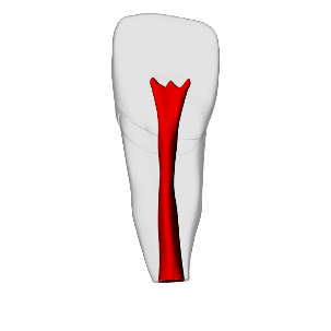 Incisor – Open apex, Pulp | Dental Training Models | DRSK