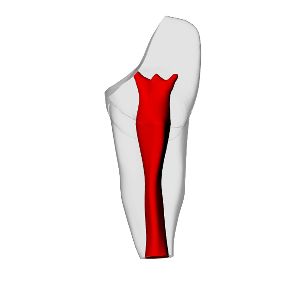 Incisor – Open apex, Pulp exposure, Radiopaque (White) | Dental Training Models | DRSK – DRSK Group AB, Demomodelle