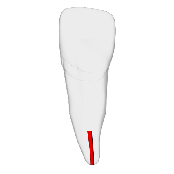 Incisor – Obliterated | Dental Training Models | DRSK
