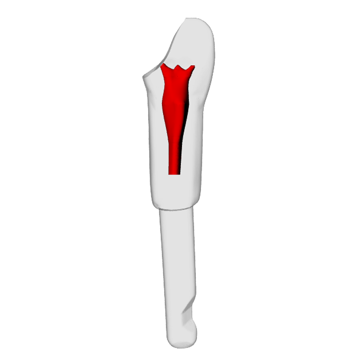 Incisor – Open apex, Pulp exposure, Kavo | Dental Training Models | DRSK