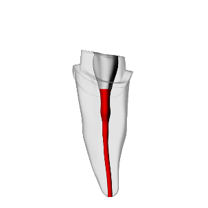 Incisor – Prepared crown, White | Dental Training Models | DRSK – DRSK Group AB, Demomodelle