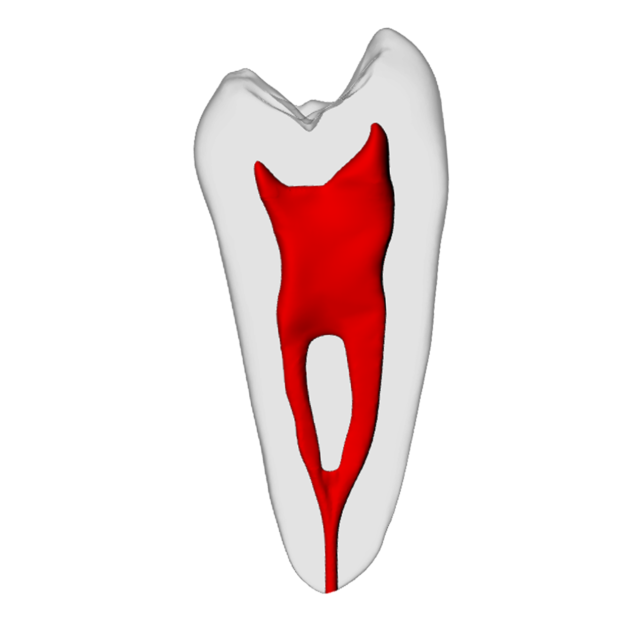 Premolar – Merging canals, Radiopaque (White) | Dental Training Models | DRSK – DRSK Group AB