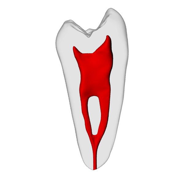 Premolar – Merging canals, Radiopaque (White) | Dental Training Models | DRSK