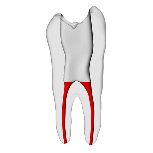 Premolar – Accessed, Basic, Radiopaque (White) | Dental Training Models | DRSK